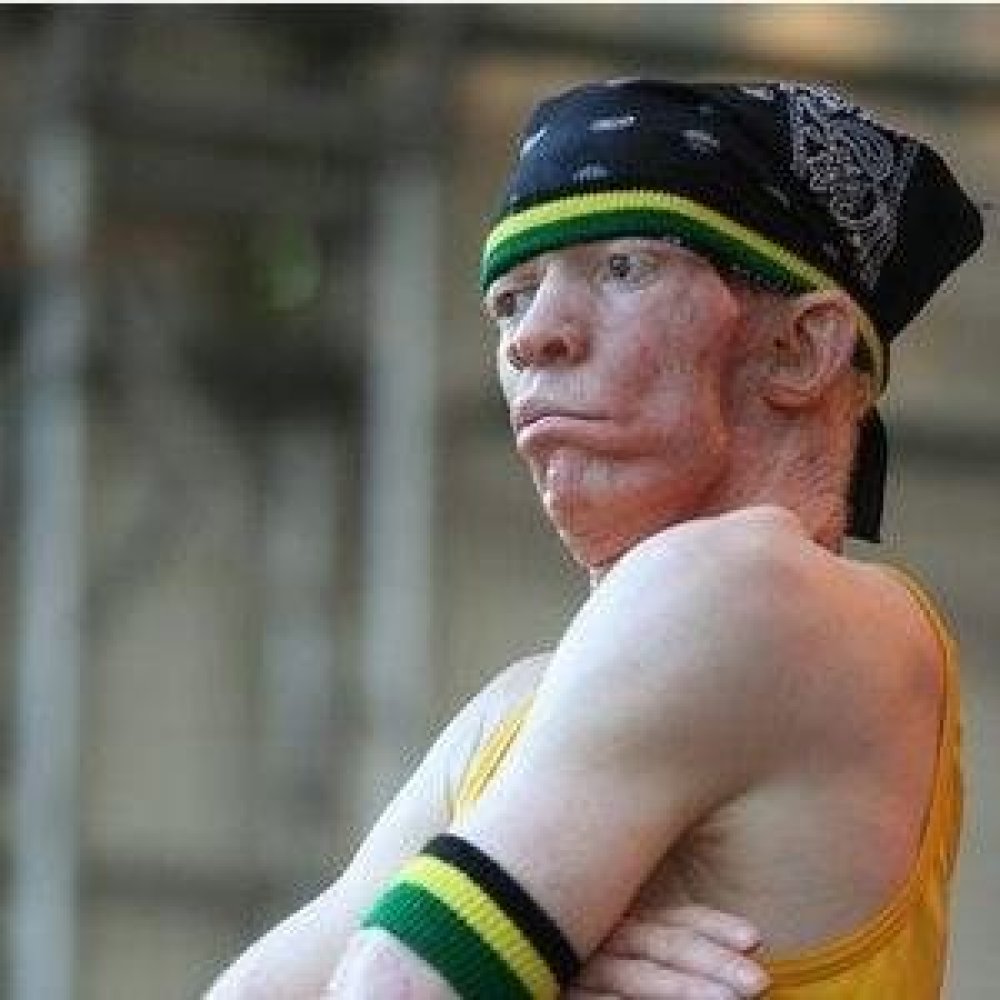 Yellowman