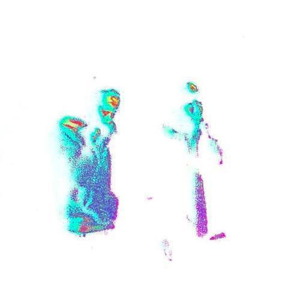 Ona