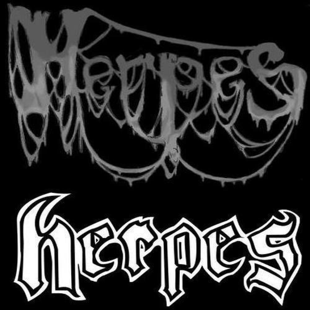 Herpes