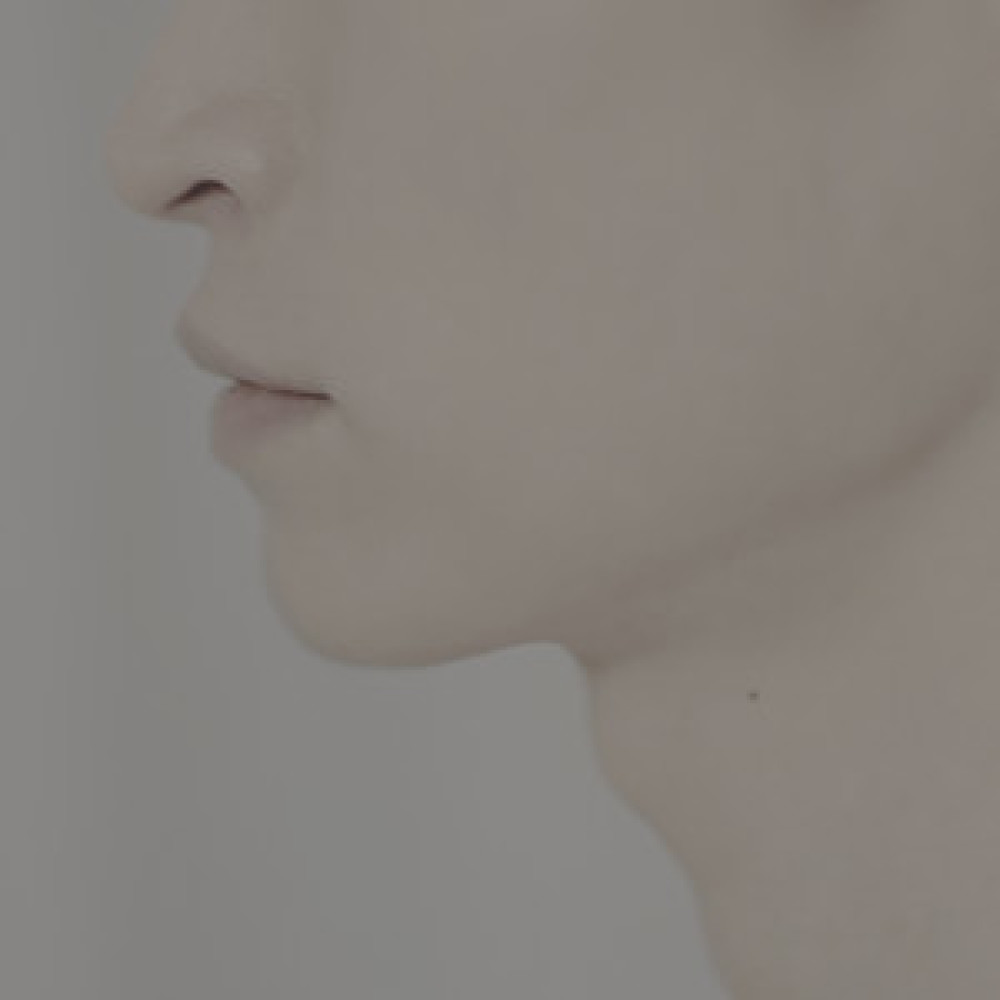 잊지마